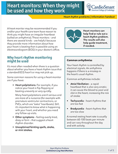 Heart Monitors: When They Might Be Used and How They Work