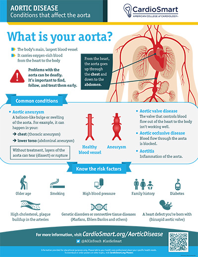 Aortic Disease: What is Your Aorta?