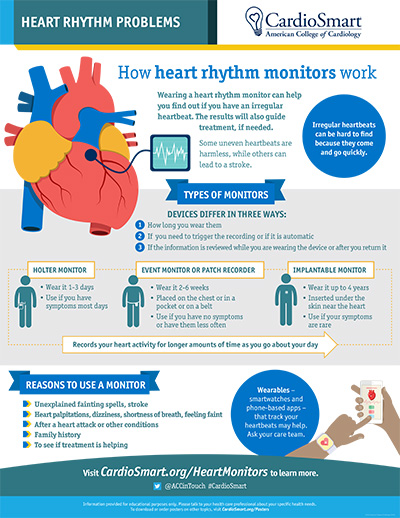 Heart Rhythm Problems: How Heart Monitors Work
