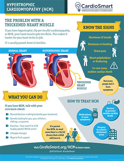 Hypertrophic Cardiomyopathy