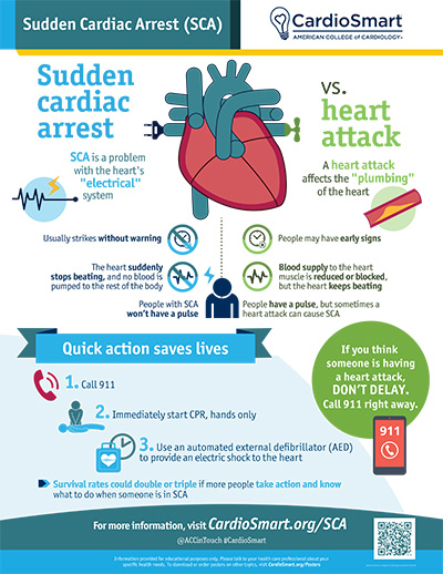 SCA: Sudden Cardiac Arrest
