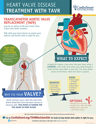 Aortic Stenosis Tavr Surgery Symptom Management Cardiosmart