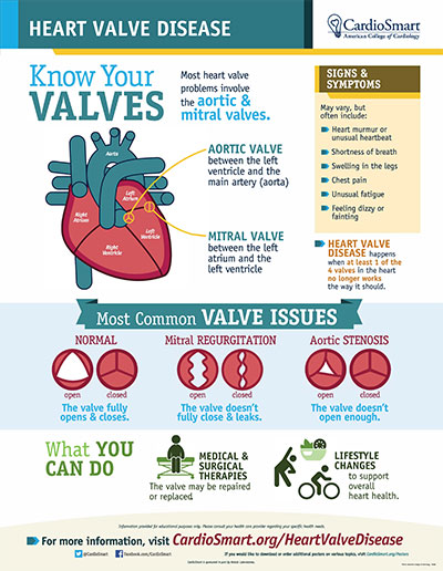 Heart Valve Disease