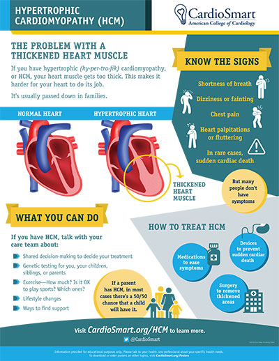 Hypertrophic Cardiomyopathy