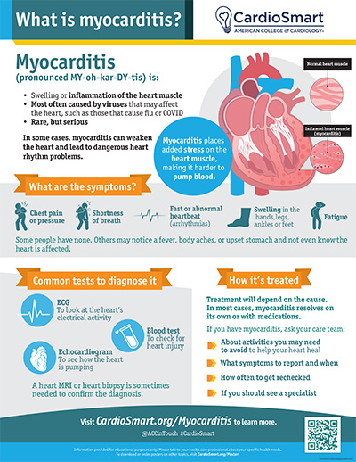 Myocarditis: What is Myocarditis?