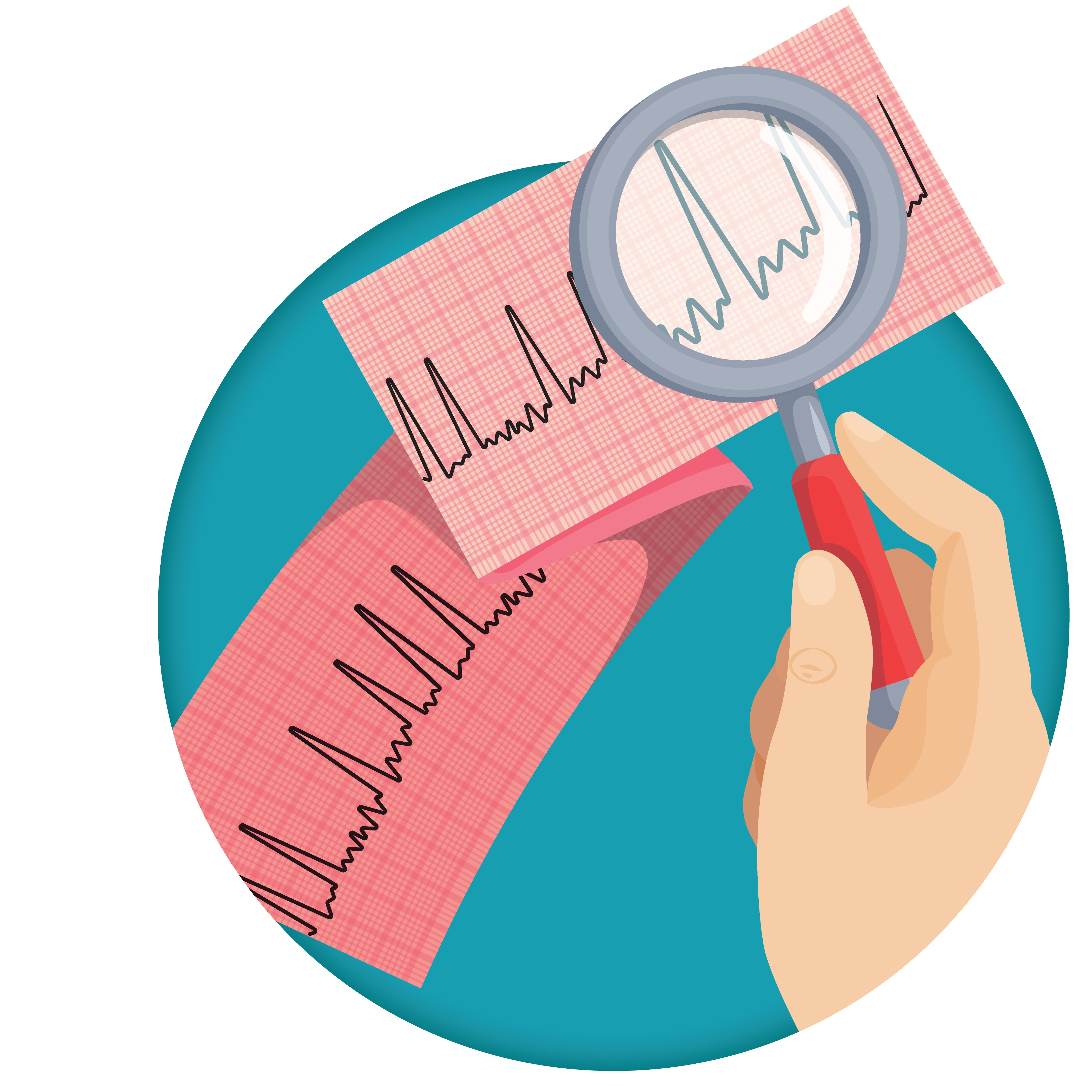 Atrial Fibrillation